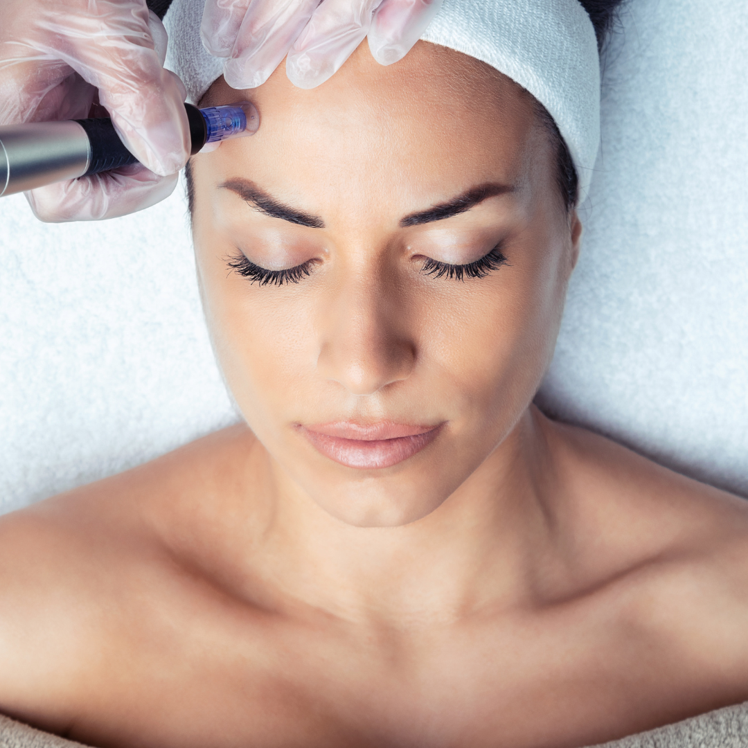 How To Maximize Your Rf Microneedling Results And Recovery Mood Skin Care